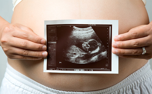 Дали матката fibroids опасни за време на бременоста?