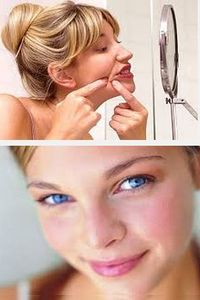 Come sbarazzarsi di acne e acne sul viso a casa