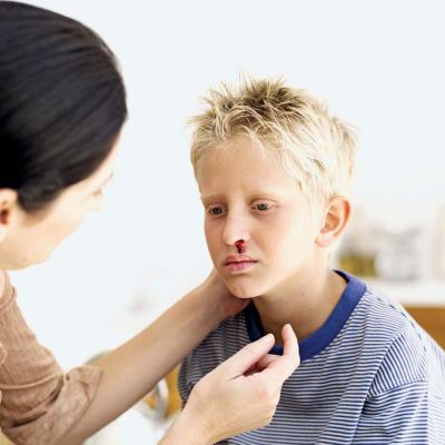 Krvácení z nosu u dítěte: příčiny a léčba