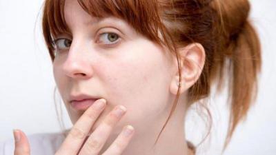 Херпес на устните - симптоми на заболяването, профилактика и лечение на народни средства