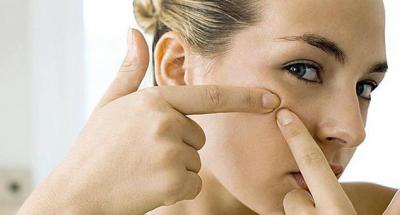 Какво причинява акне по лицето? Причини и лечение