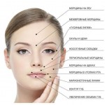 Prednosti in slabosti injekcij Botoxa proti gubam