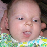 Какво причинява млечницата при новородените