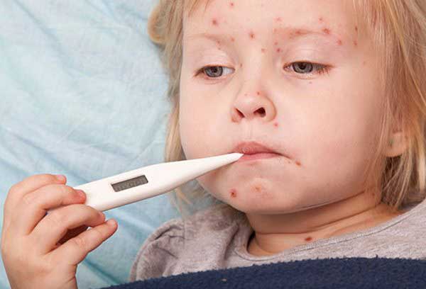 Rash e febbre da bambino: possibili cause