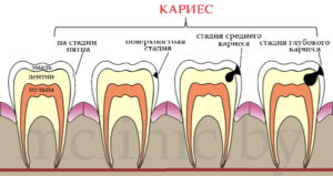 Modalități de îngrijire a dinților și a gingiilor la domiciliu