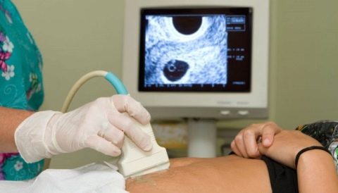 8 teden nosečnosti: znaki, simptomi, ultrazvok