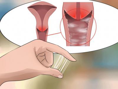 Vaginální výtok: příčiny, léčba a účinky