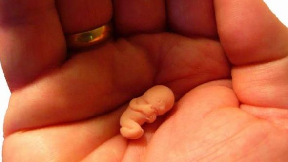 Škrábání při nezapomenutelném potratu: co to je?